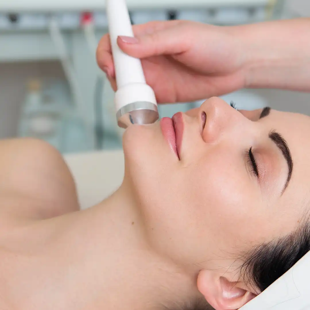 microdermabrasion